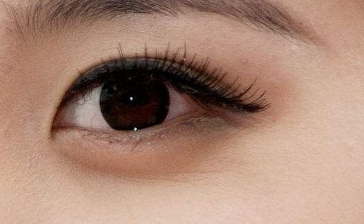 重慶軍美吸脂效果怎么樣？真實案例見證顯著術后效果