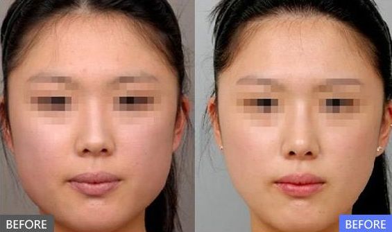 成都整形美容醫(yī)院綜合排行榜Top10出爐！這些醫(yī)院受歡迎程度堪比明星哦！