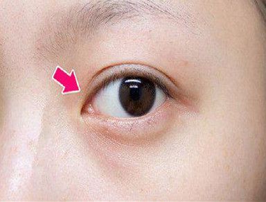 揚(yáng)州哪家整形醫(yī)院技術(shù)好？