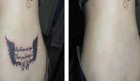 雙眼皮手術(shù)醫(yī)院推薦，一站式解決開眼角問題