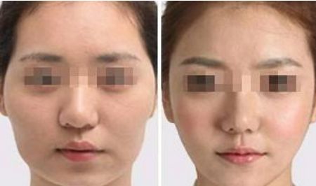 武漢熙蒙整形醫(yī)院信譽(yù)如何醫(yī)生介紹、費(fèi)用更新了！