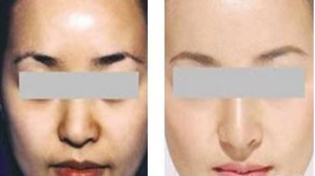 【2024全國頂級隆鼻醫(yī)院科普】大連top10醫(yī)院排行榜揭曉