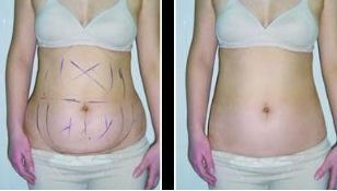 【2024】遼陽市更受歡迎的美容整形機(jī)構(gòu)排名TOP10