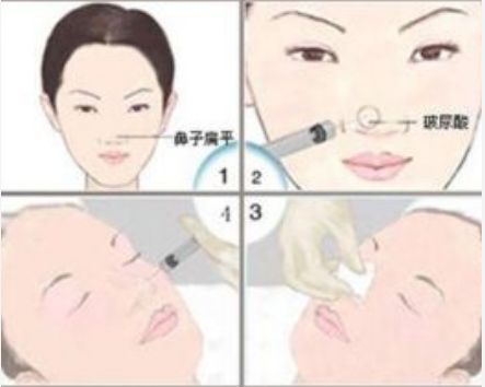 邯鄲維多利亞美容醫(yī)院體驗全解析：門診介紹及價格指南