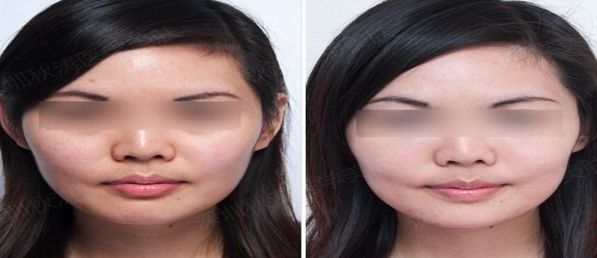 北京醫(yī)美行業(yè)領(lǐng)先者揭曉，排名前十大公示