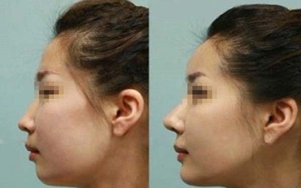 清明節(jié)鄭州中醫(yī)一附院趙絳波出診時(shí)間表