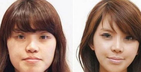 【2024】武漢整形醫(yī)院推薦前十強(qiáng)