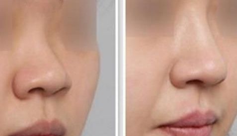 沈陽杏林醫(yī)院官網(wǎng)詳解領先技術(shù)，臉部果展示讓你重獲自信