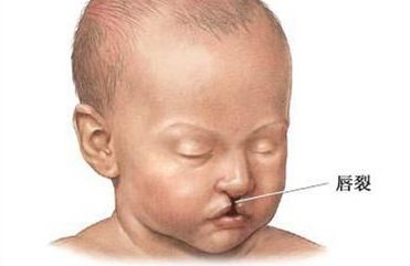 內(nèi)蒙古附屬醫(yī)院點陣激光體驗分享，了解一下這項先進技術(shù)吧！價格表附后！