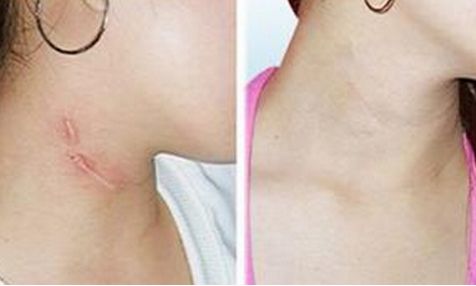 滄州京美醫(yī)療美容服務(wù)項(xiàng)目一覽表，請(qǐng)您參考