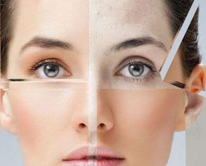 11月16日，喬雅登緹顏國內(nèi)首發(fā)發(fā)布會(huì)震撼北京，沈陽百嘉麗首發(fā)力挺