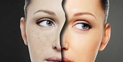 盤(pán)點(diǎn)2024年武漢哪家醫(yī)院能夠進(jìn)行自體脂肪填充術(shù)