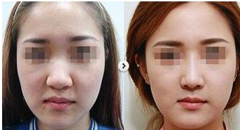 西安疤痕修復(fù)醫(yī)院口碑榜單，這4家實力出眾