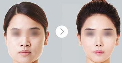 廣州耳再造醫(yī)院綜合評價曝光，醫(yī)療技術領跑全國