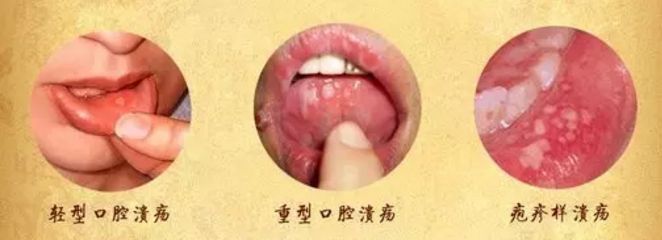 北京眼袋整形醫(yī)院排名大揭秘，最佳去眼袋選擇！