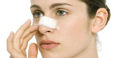 找醫(yī)生修復(fù)雙眼皮，怎樣找到醫(yī)生王莉莉的優(yōu)秀案例？