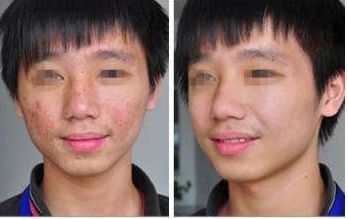 頂尖廣州隆胸修復(fù)整形醫(yī)院排行榜