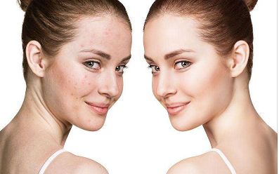 蘭州去眼袋醫(yī)院哪家好？ 一指選出專業(yè)吸脂治療