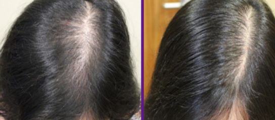 杭州綜合整形醫(yī)療界的翹楚，實(shí)至名歸，來挖掘一下吧！