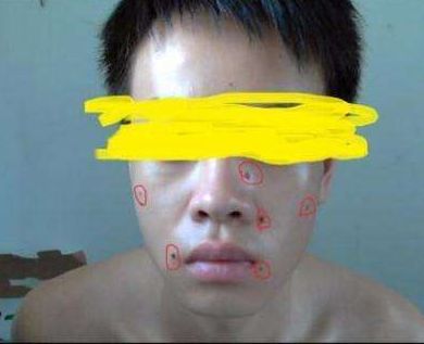 ?？谑笳吾t(yī)院匯總，哪家效果比較好？