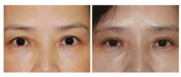 廣州整形醫(yī)院排名：領(lǐng)銜藝美、威利斯、美涵！