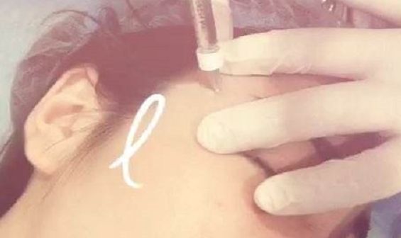 深圳前海地區(qū)哪家整形醫(yī)院比較靠譜？好的深圳整容醫(yī)院有哪些？