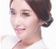 2024年太原頂級(jí)整形醫(yī)院排名曝光，專家評(píng)選出的前10強(qiáng)！