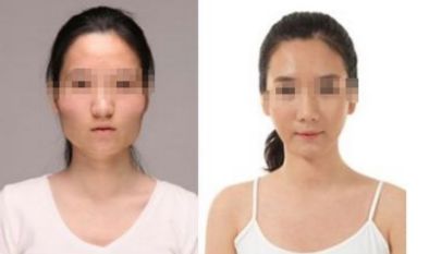 沈陽軍區(qū)總醫(yī)院整形美容科專家介紹與收費標準