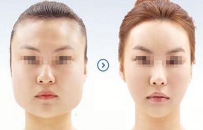 2024年溫州哪家醫(yī)院的整形美容效果最佳？