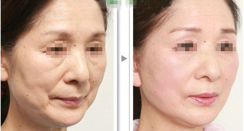 云南頂尖整容醫(yī)院盤(pán)點(diǎn)，打造完美容顏秘密揭示