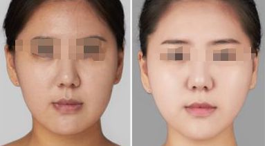 2024年惠州哪些整形醫(yī)院口碑好？