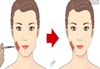 武漢哪家醫(yī)院治療疤痕效果好呢？