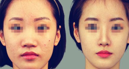 深圳整形醫(yī)院推薦-美萊多項(xiàng)整形項(xiàng)目專業(yè)可信