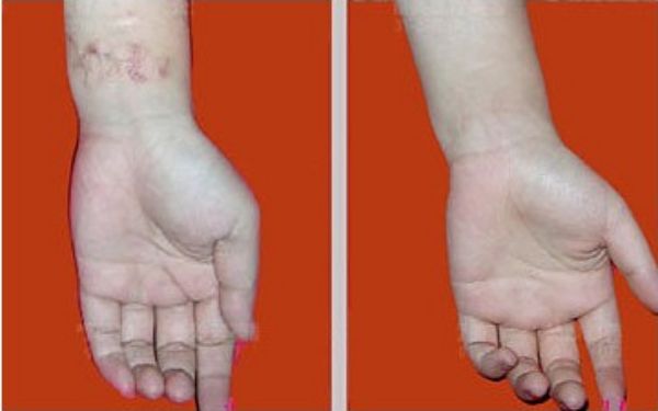 【雙眼皮專家駕到！武漢中翰整形醫(yī)院付毅院長(zhǎng)親診雕刻美眼】