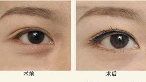 樂山人民醫(yī)院醫(yī)生特色項目與服務(wù)評價全解析