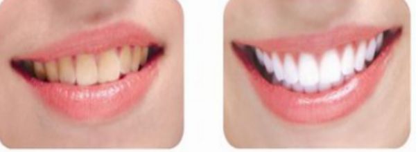 深圳眼修復(fù)醫(yī)院排名口碑好：陽光、廣和、美加美價(jià)格一覽表