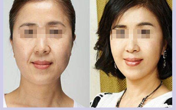 溫州哪家整形醫(yī)院口碑好？排名榜單揭曉