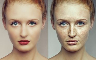 昆明三甲醫(yī)院激光美容推薦TOP5，解析裝修比較好的臨床醫(yī)生一線分享