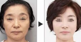 西安哪家醫(yī)院擅長面部輪廓整形？