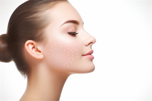 沈陽伊美爾超聲吸脂雙下巴效果全解析