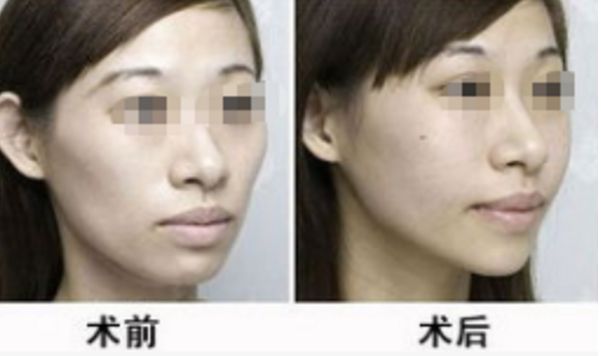 湖北地區(qū)整形醫(yī)院評選榜單，醫(yī)術高超排名靠前的醫(yī)療機構