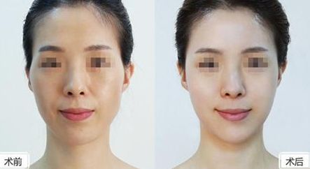 深圳美萊整形醫(yī)院位置介紹，牽手醫(yī)生，搶先體驗(yàn)熱門項(xiàng)目