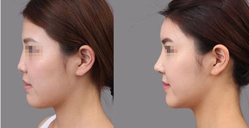 2024年昆明整形醫(yī)院綜合排行榜TOP10曝光