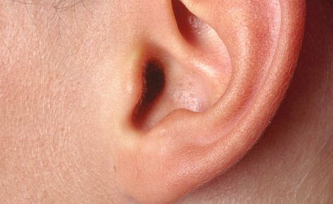 鄭州人民醫(yī)院眼袋手術(shù)價(jià)格及費(fèi)用參考