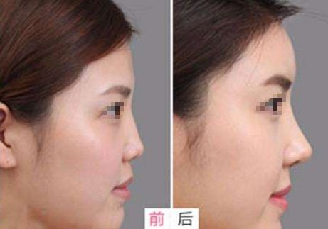 相山愛(ài)美爾醫(yī)療美容門診部，多項(xiàng)特色項(xiàng)目亮相，幫助您煥發(fā)美麗