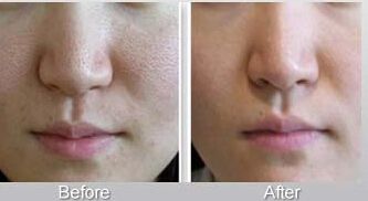 廣州天河區(qū)美容整形醫(yī)院優(yōu)選推薦