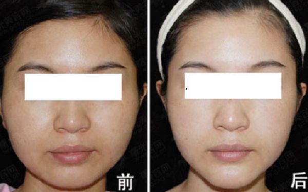 重慶市知名整形美容醫(yī)院榜單出爐！引領(lǐng)時尚潮流的醫(yī)療機(jī)構(gòu)盤點