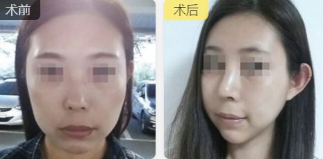 福州中聯(lián)美康醫(yī)療美容門診部的醫(yī)生技術及擅長項目推薦