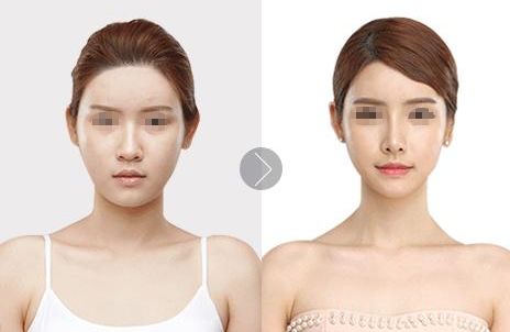 徐州處女膜修復(fù)整形美容：這些醫(yī)院值得一看！想在徐州手術(shù)，不容錯(cuò)過！