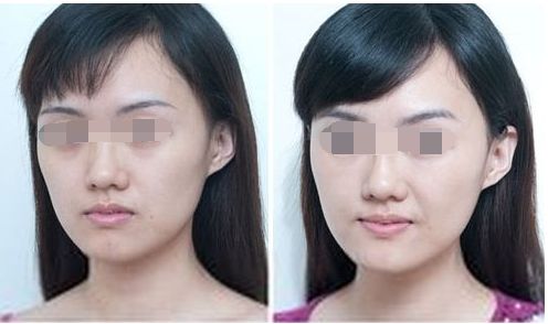 中山整形醫(yī)院八強(qiáng)名單公開！看看這些優(yōu)質(zhì)醫(yī)院是否入選受關(guān)注！